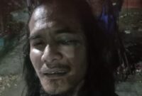 Foto korban seorang jurnalis yang dikeroyok ketika meliput 