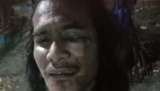 Foto korban seorang jurnalis yang dikeroyok ketika meliput 