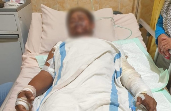 Foto: warga Dukuh Badong Geneng, Desa Klopoduwur, Kecamatan Blora, tersengat listrik