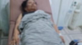 Foto : Korban ketika dirawat 