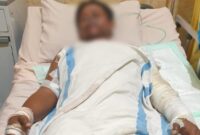 Foto kondisi korban ketika Dirawat di Rumah Sakit 