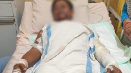 Foto kondisi korban ketika Dirawat di Rumah Sakit 