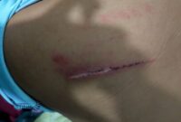 Foto luka luka korban dan mengalami trauma mendalam atas kejadian penganiayaan tersebut 