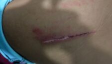 Foto luka luka korban dan mengalami trauma mendalam atas kejadian penganiayaan tersebut 