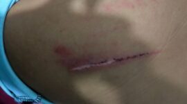 Foto luka luka korban dan mengalami trauma mendalam atas kejadian penganiayaan tersebut 