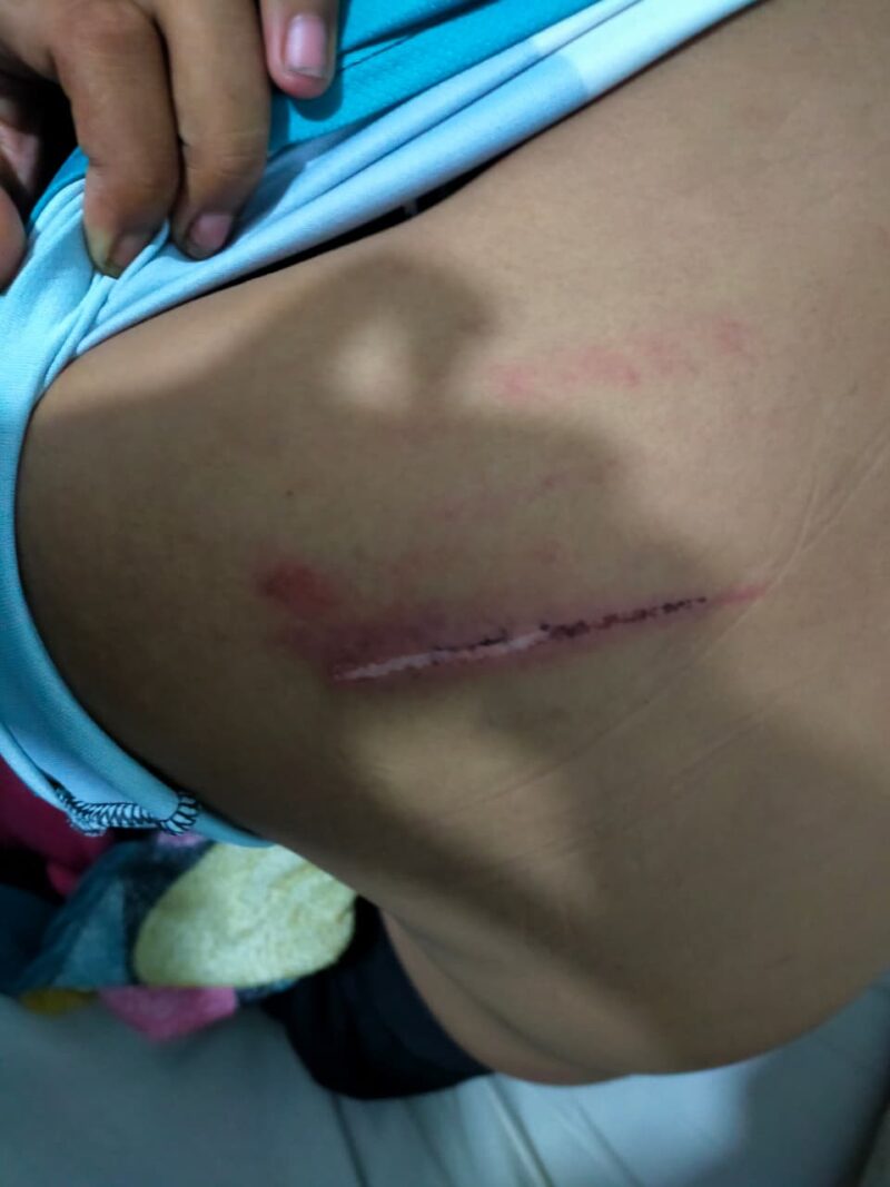 Foto luka luka korban dan mengalami trauma mendalam atas kejadian penganiayaan tersebut 